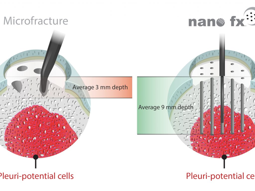 nanoillustration